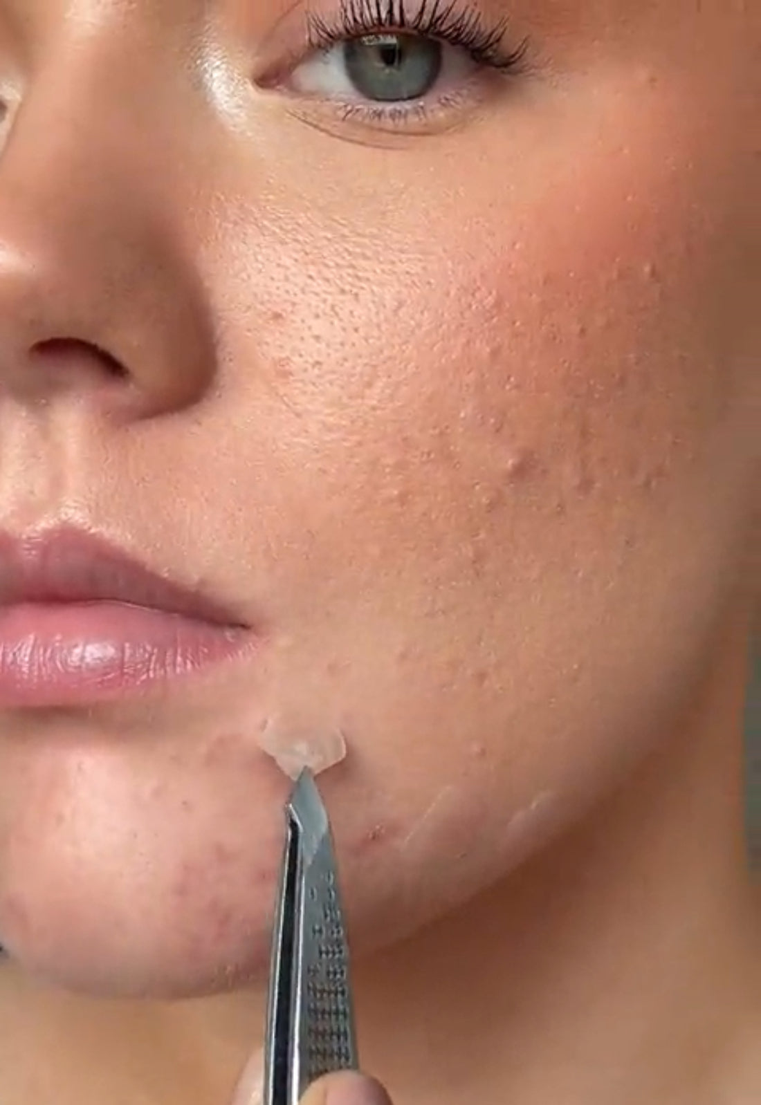Guide: How to use pimple patches with makeup
