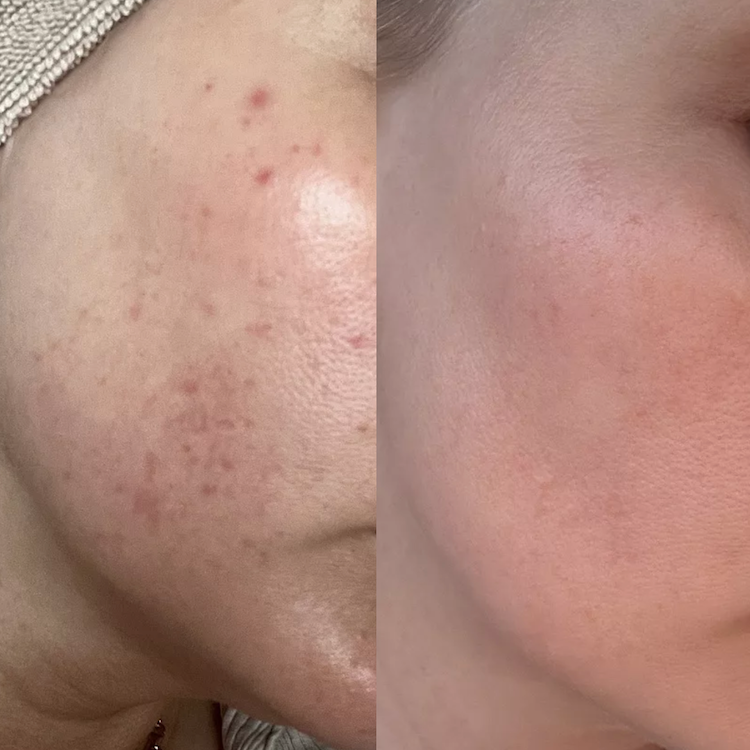 Before and after pictures showing the results after using Common Clouds products.