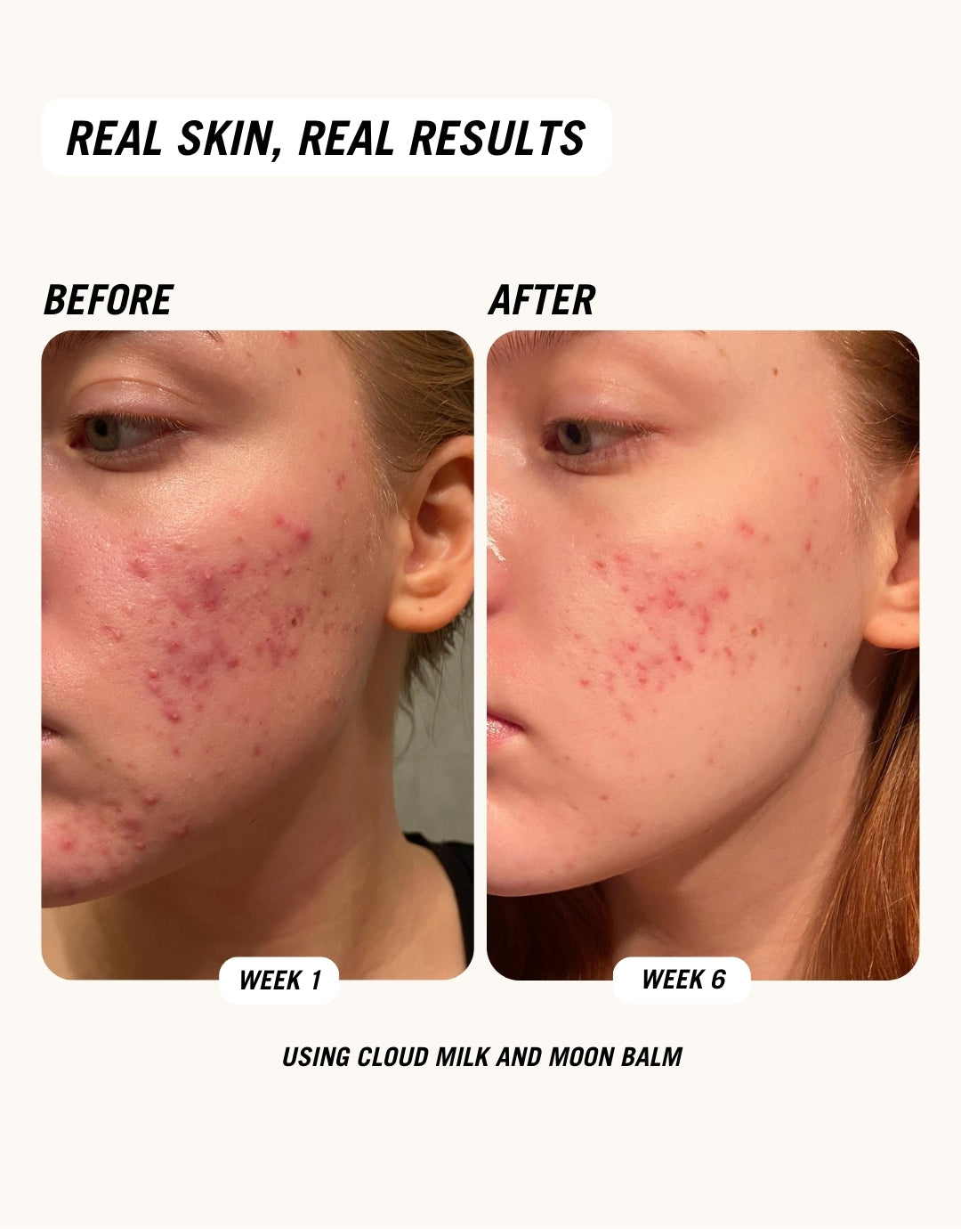 Before and after images showing the results of using Cloud Milk