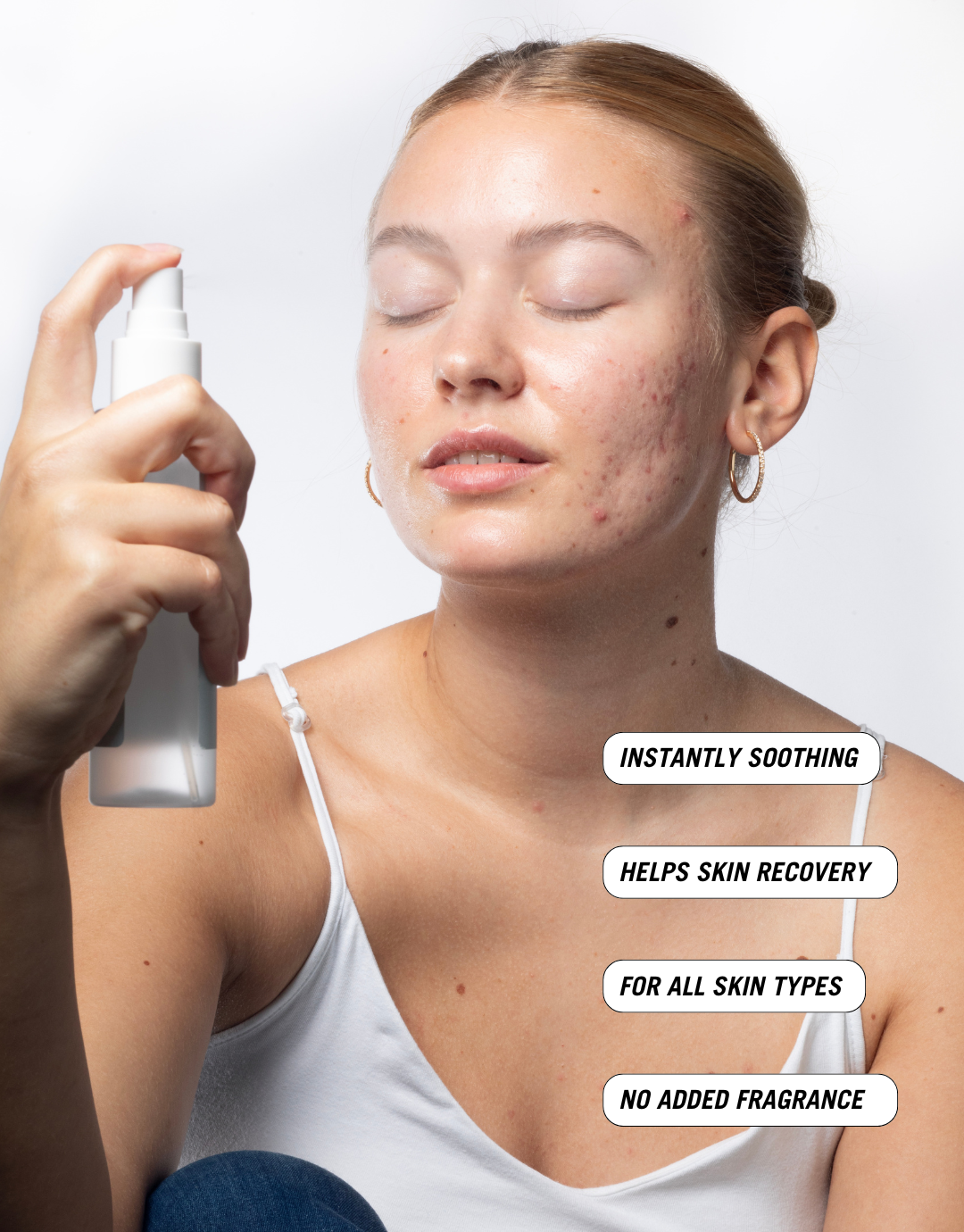 A young woman with acne-prone skin applies a face mist from Common Clouds. Her eyes are closed as she sprays the Cloud Mist towards her face. Text around her highlights key benefits: "instantly soothing", "helps skin recovery", "for all skin types", and "no added fragrance"