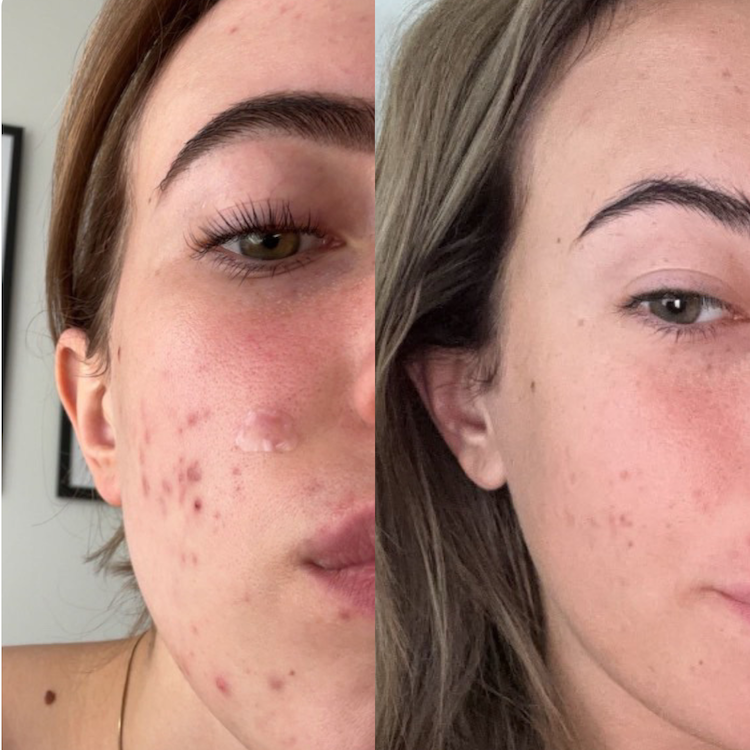 Before and after pictures showing the results after using Common Clouds products.
