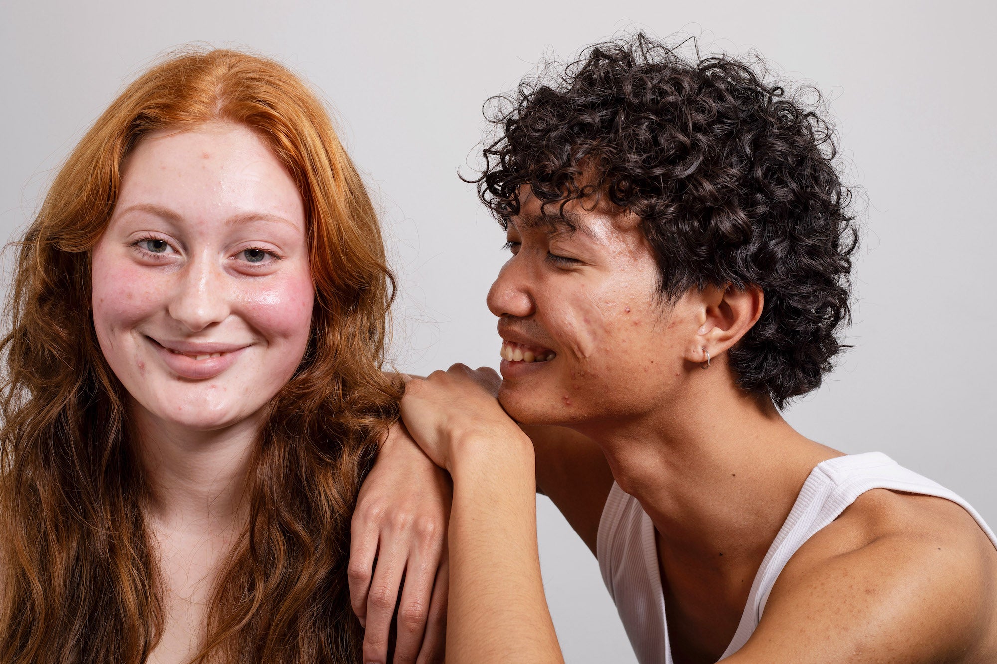 Girl and boy wearing Common Clouds pimple patches