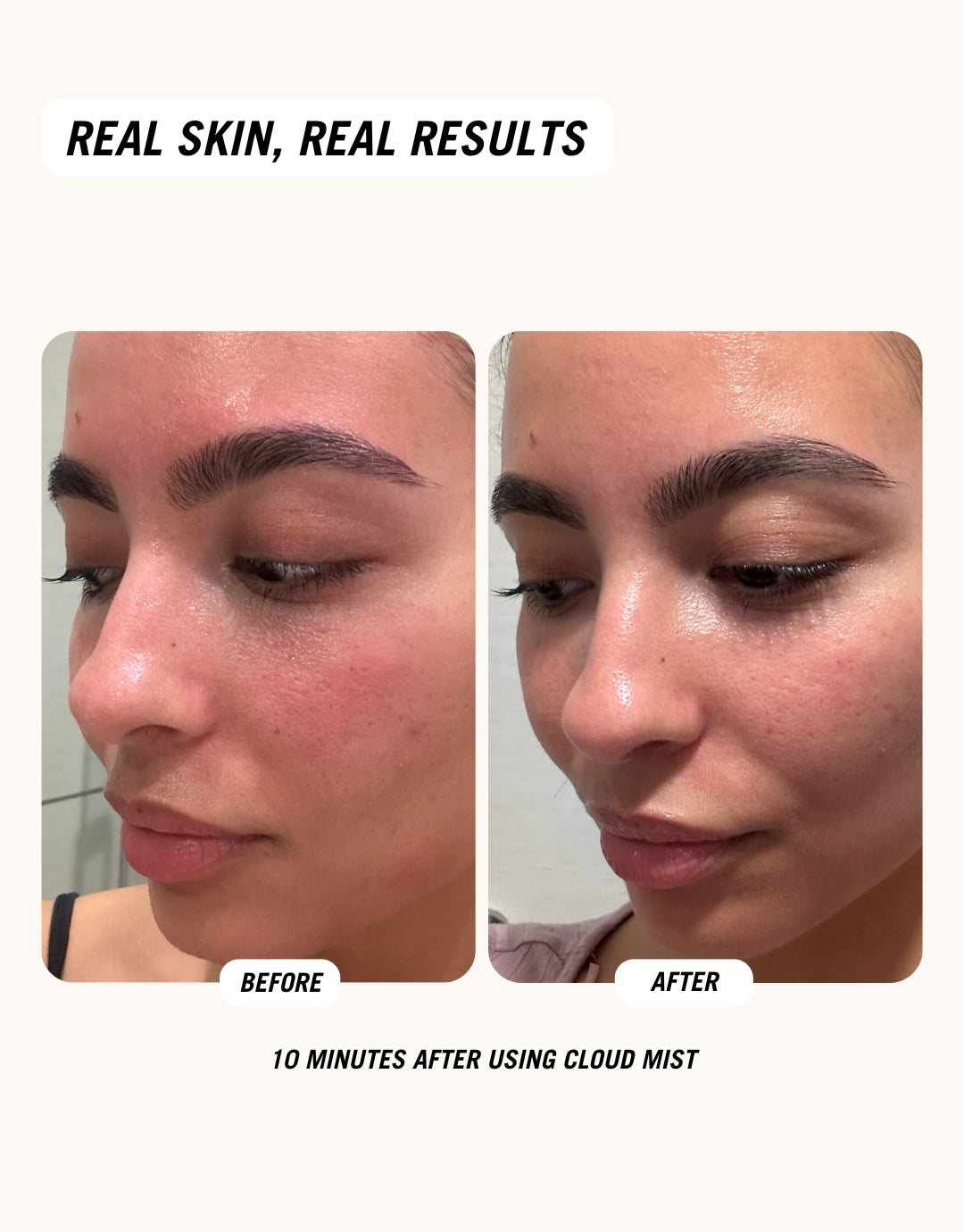 Before and after images showing the result after using Common Clouds soothing SOS Hypochlorous acid spray.
