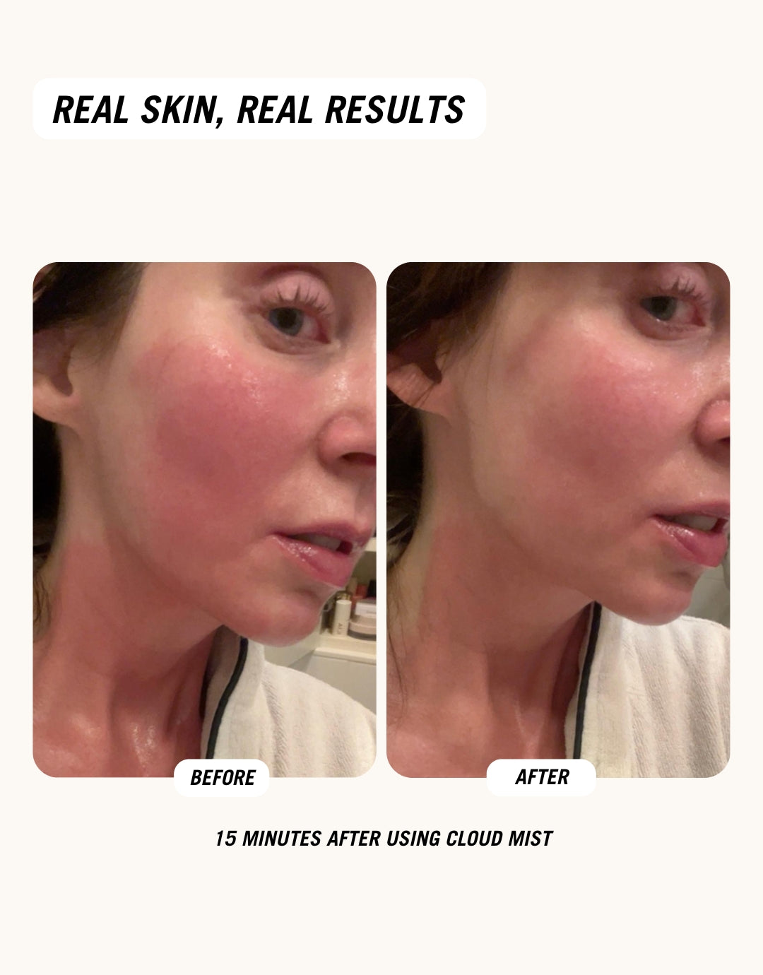 Before and after images showing the result after using Common Clouds soothing SOS Hypochlorous acid spray.