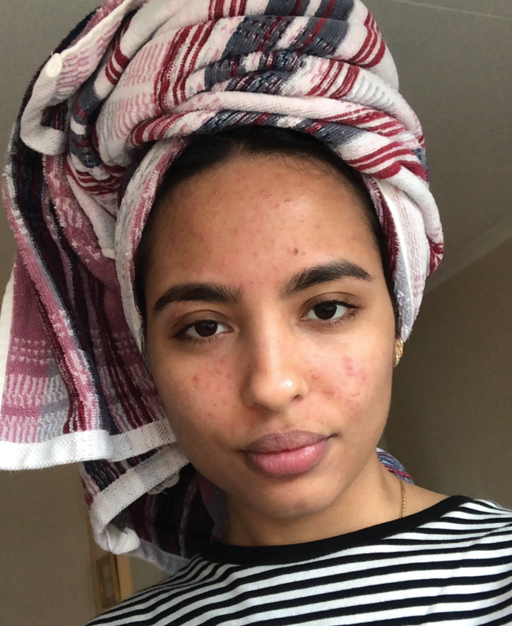 Beauty/skincare influencer Amanda Mergyra 