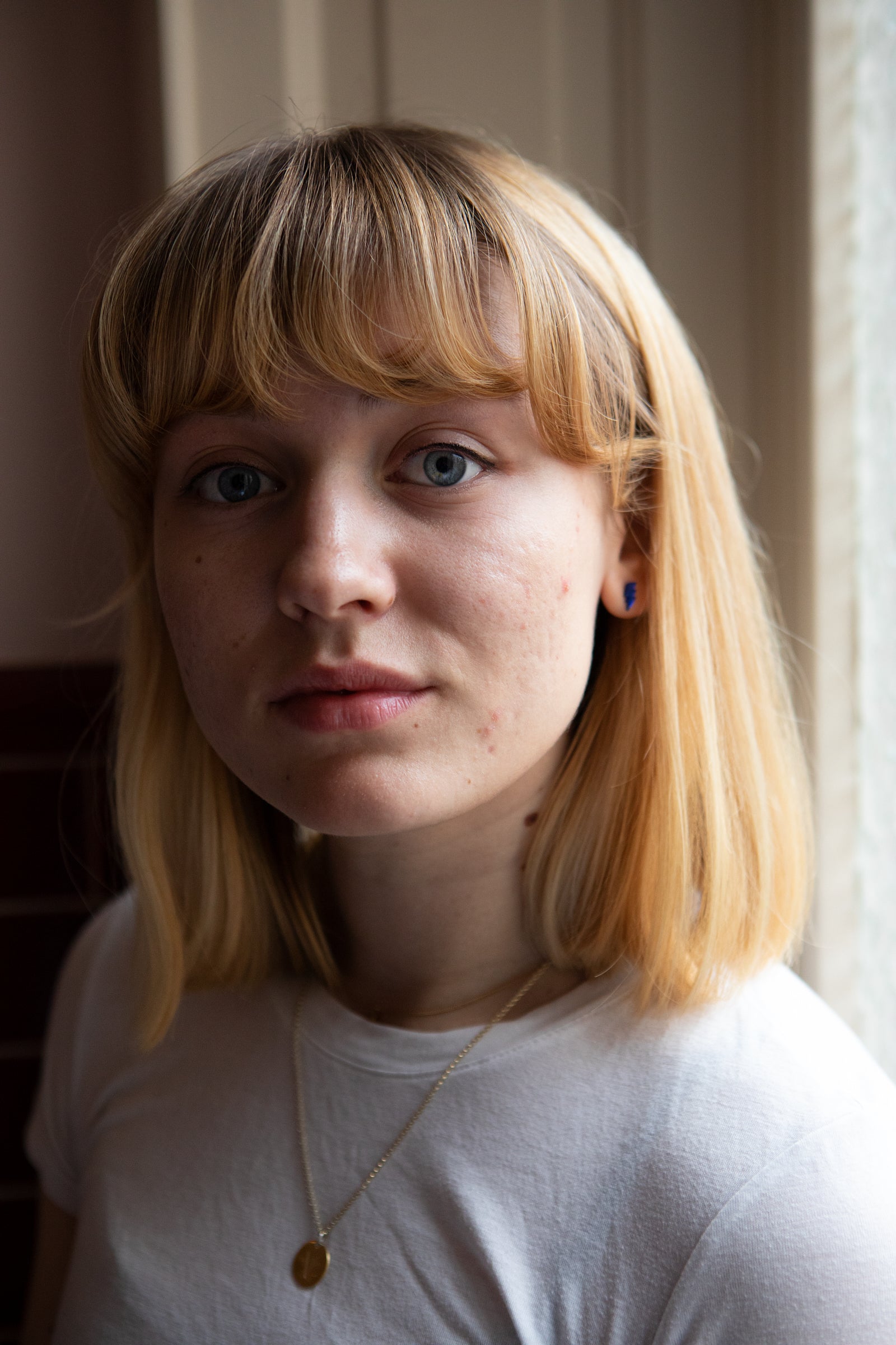 The 3 Menstrual Phases Impact On Skin Acne Breakouts Common Clouds the-3-menstrual-phases-impact-on-skin-acne-breakouts-common-clouds