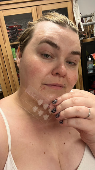 margareta grääs with cloud pimple patch finnplåster