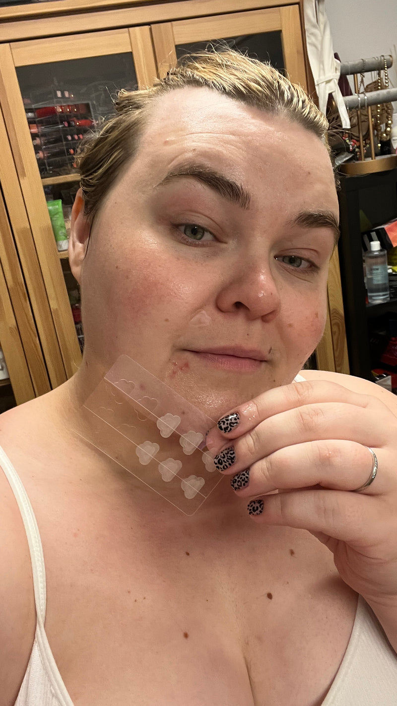 margareta grääs with cloud pimple patch finnplåster