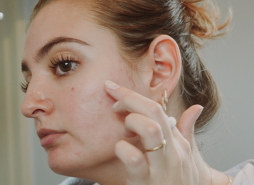 cloud shaped pimple patch acne patch akneplåster finnplåster