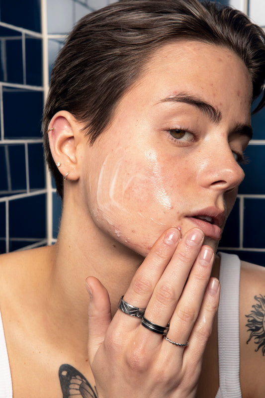 Acne Awareness Month - What is acne and how can I treat it?