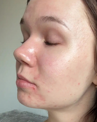 Close-up side profile of a person