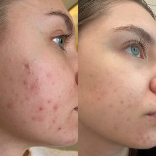 Before and after comparison of a person