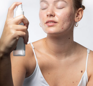 A girl sprays Cloud Mist, a hypochlorous acid with centella from Common Clouds.