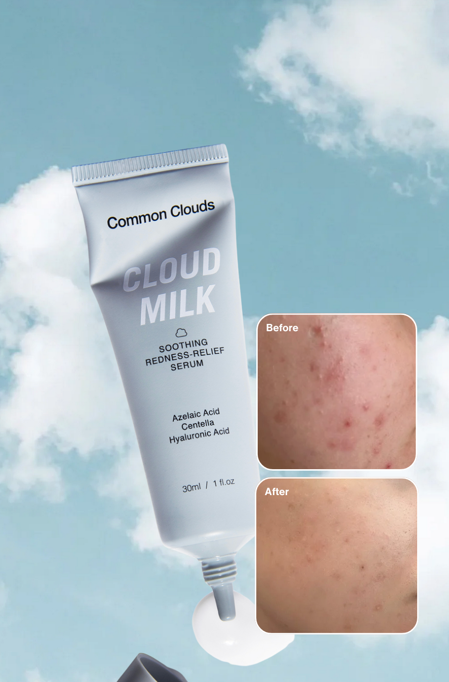 Tube of Common Clouds Cloud Milk with 'Before' and 'After' skin comparison on a sky background.