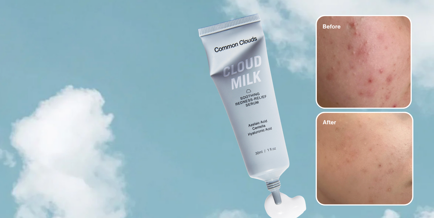 Tube of Common Clouds Cloud Milk with 'Before' and 'After' skin comparison on a sky background.
