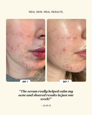 Before and after comparison on a person