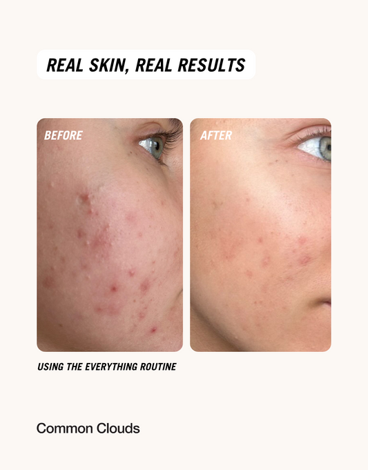 Before and after comparison of skin using a routine, with 'Real Skin, Real Results' text.