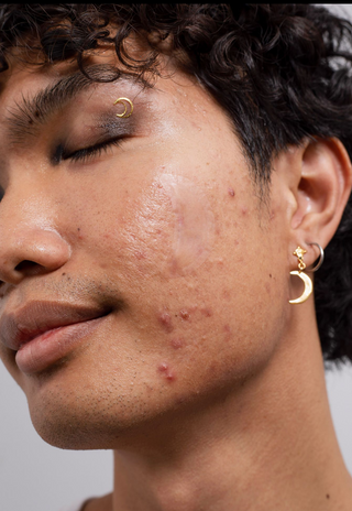 Close-up portrait of a young man with textured skin, acne, and gold moon earrings, eyes closed in a calm expression